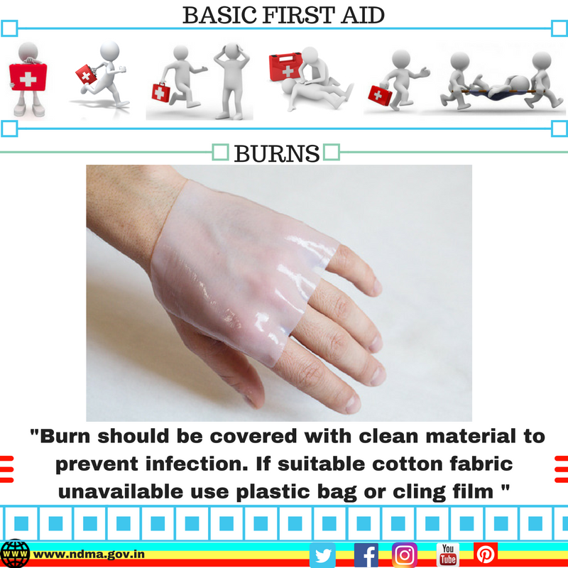 Burn should be covered with clean material to prevent infection. If suitable cotton fabric is unavailable, use plastic bag or cling film 
